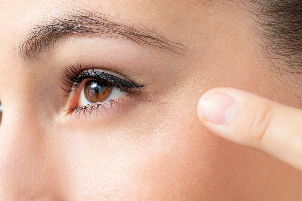 lose-up of a woman’s eye showing fine lines at the outer corner, commonly known as crow’s feet, before BOTOX® treatment.