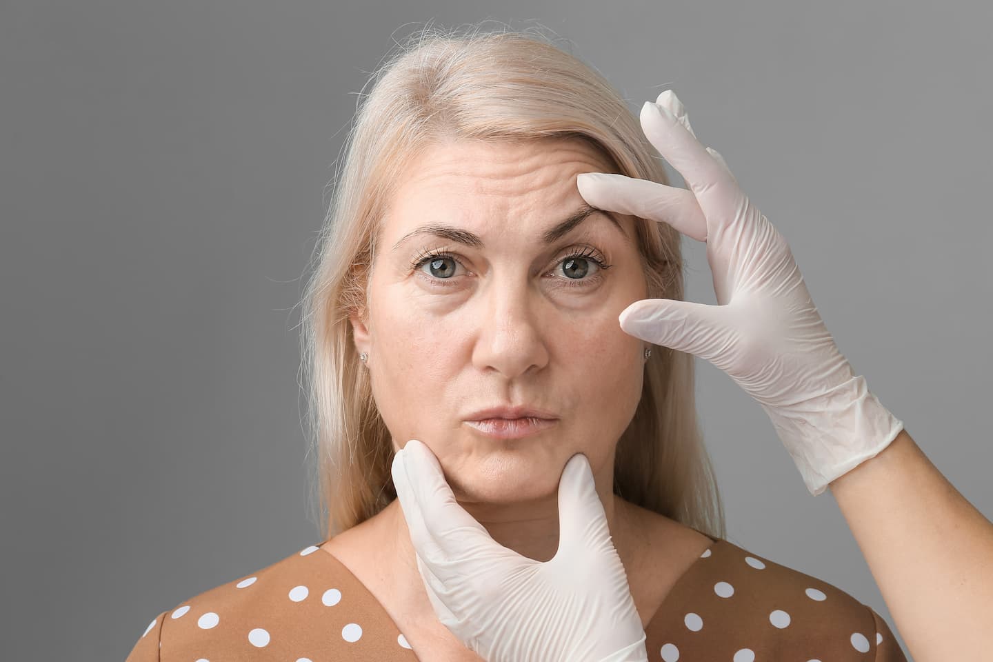 Middle-aged woman being evaluated by a medical professional wearing gloves, gently lifting her brow and chin to assess sagging skin before a potential BOTOX® brow lift treatment.